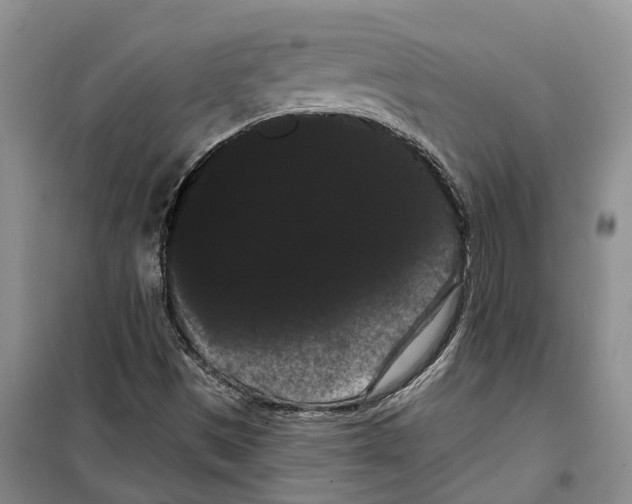 X0000099381497200806051109