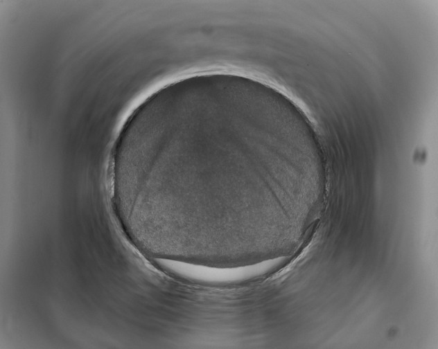 X0000099381510200806051109