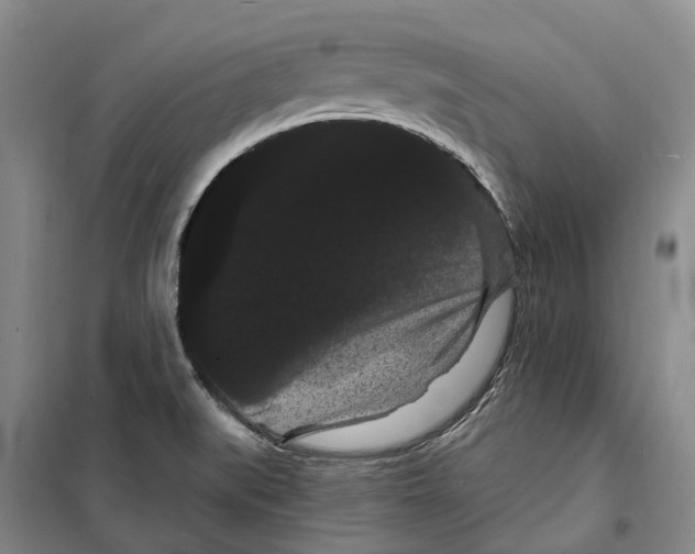 X0000099381519200806051109