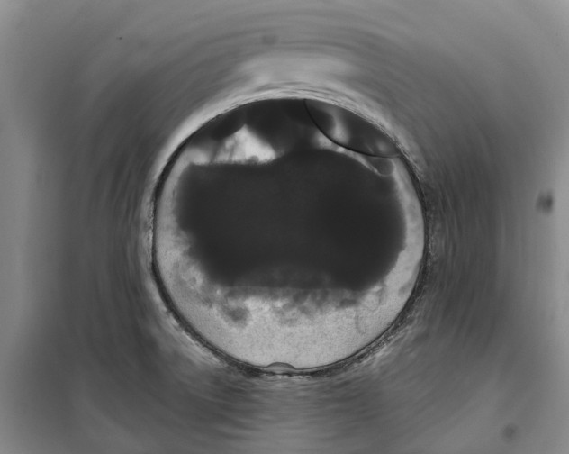 X0000099381522200806051109