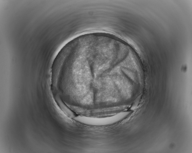 X0000099381524200806051109