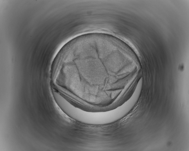 X0000099381532200806051109