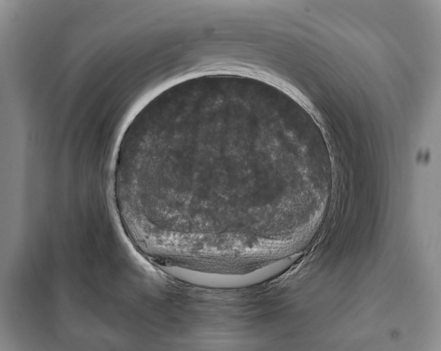 X0000099381536200806051109