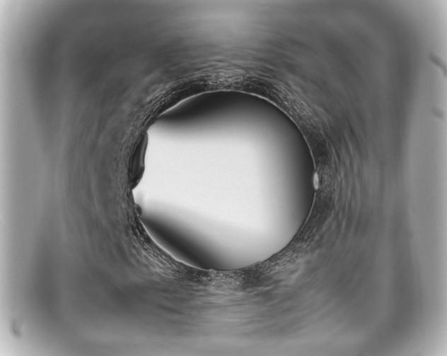 X0000099401153200805081528
