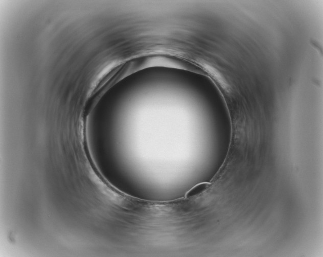 X0000099401476200805081523