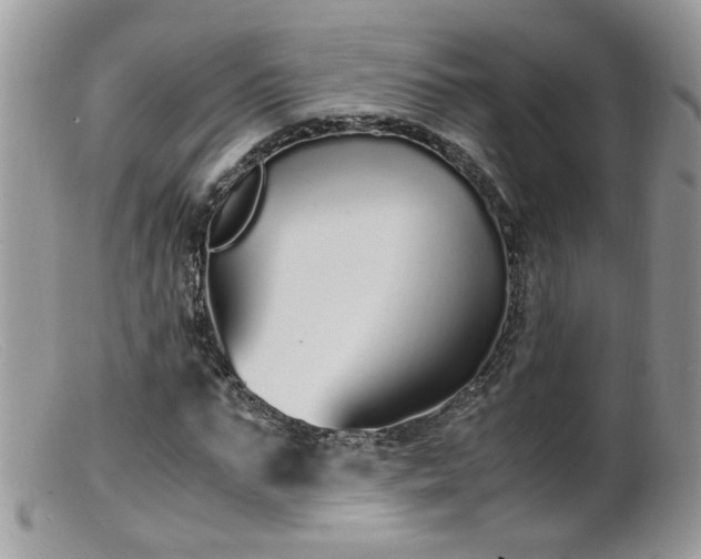 X0000099400871200805151703