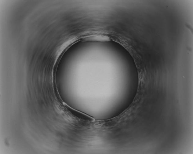 X0000099400148200805221904