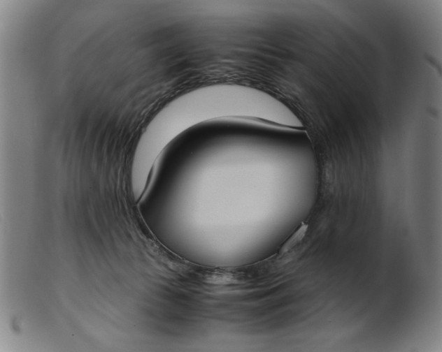 X0000099400177200805221904