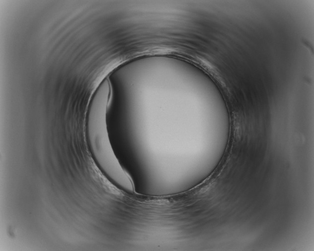 X0000099401186200805221848