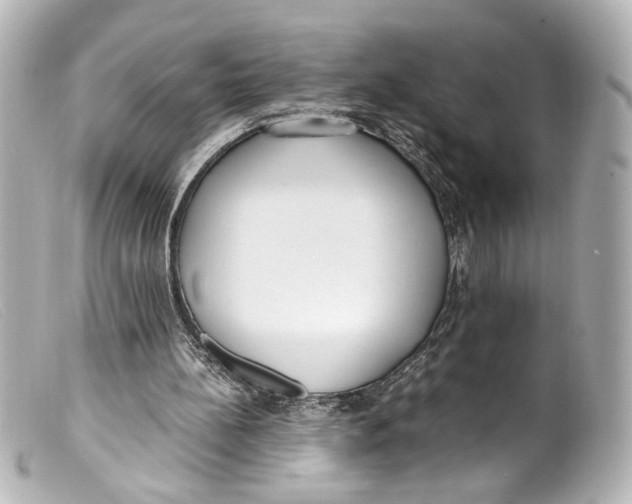 X0000099400148200805291217