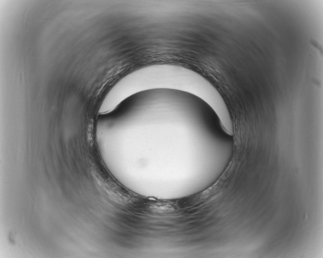 X0000099400175200805291217