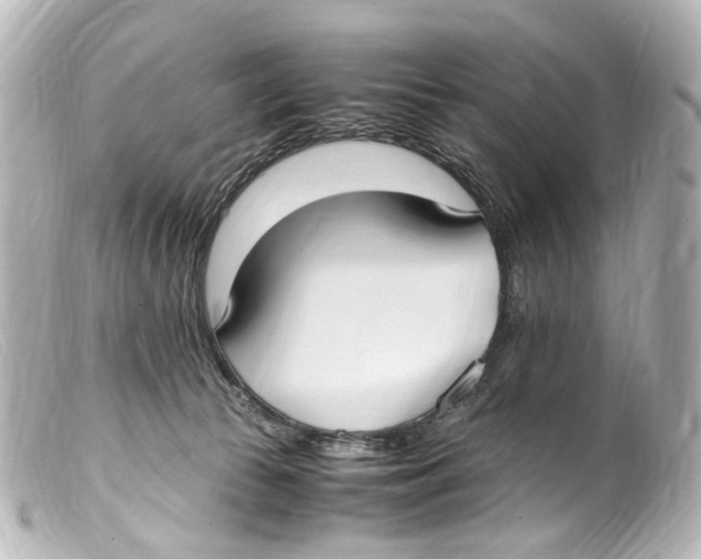 X0000099400177200805291217