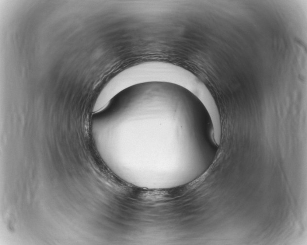 X0000099400179200805291217