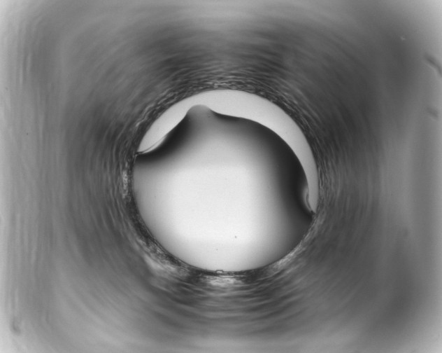 X0000099400183200805291217