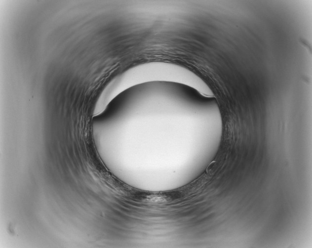 X0000099400218200805291217