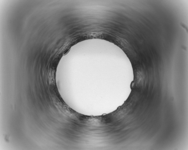 X0000099400236200805291216