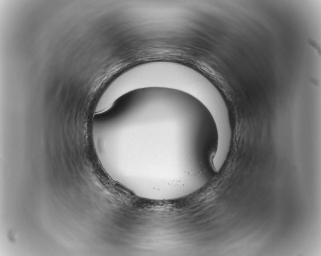 X0000099400306200805291215