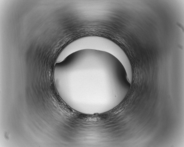 X0000099400314200805291215