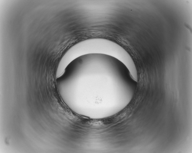 X0000099400322200805291215