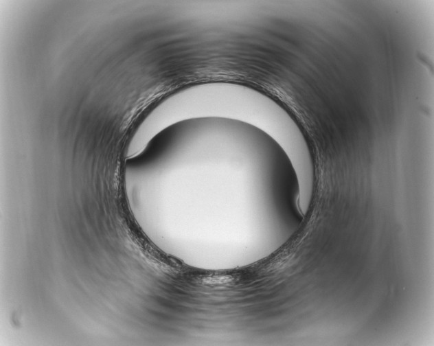 X0000099400357200805291215