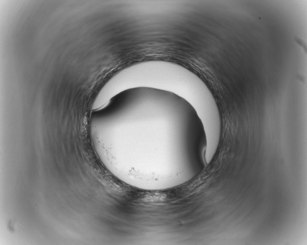 X0000099400369200805291215