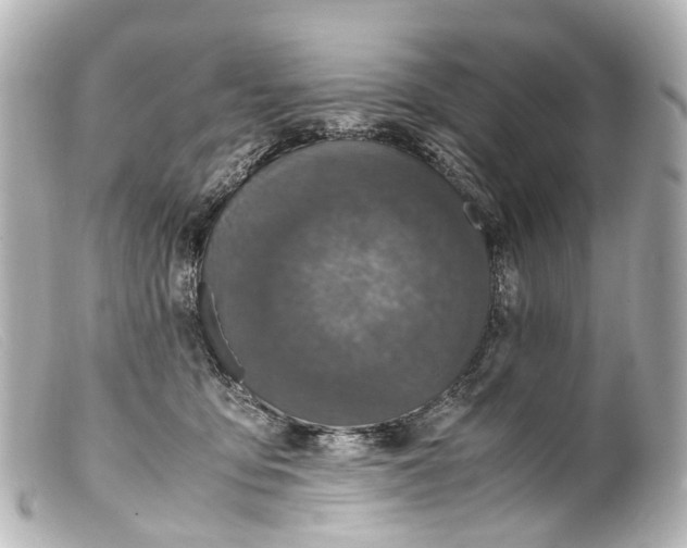 X0000099400419200805291214