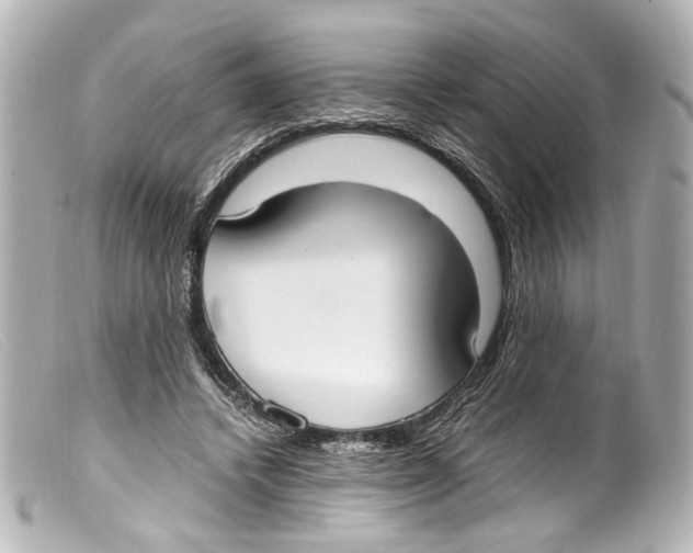 X0000099400448200805291213