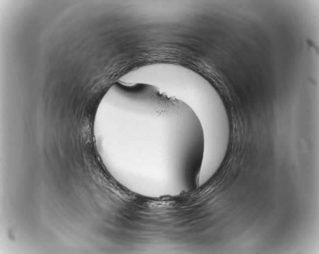 X0000099400465200805291213