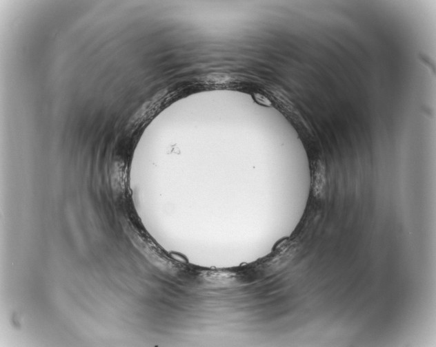 X0000099400476200805291214