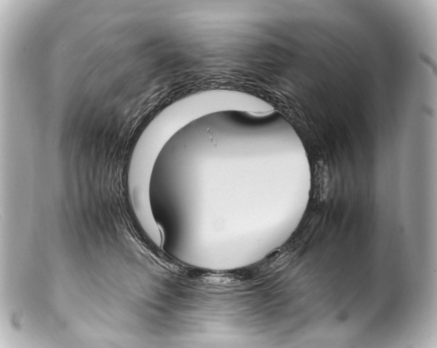 X0000099400614200805291211