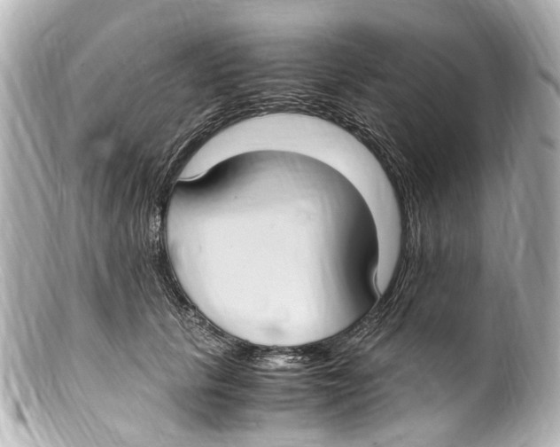 X0000099400657200805291211