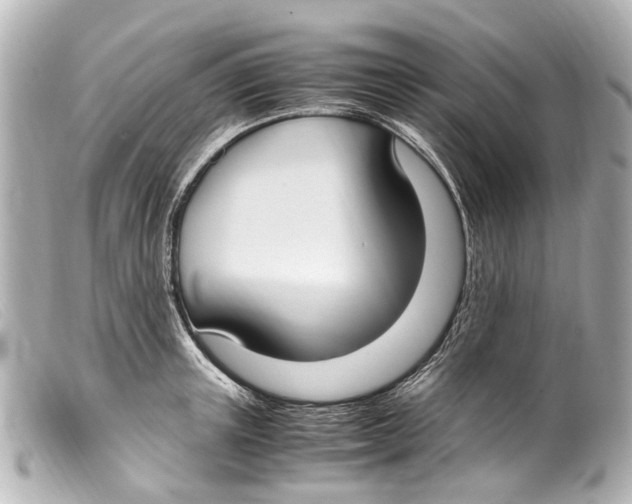 X0000099400851200805291208