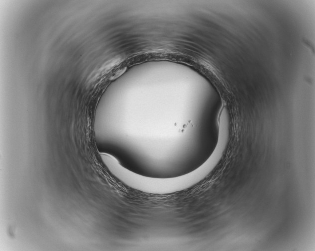 X0000099401111200805291204