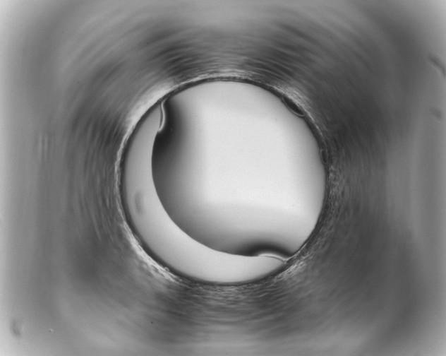 X0000099401135200805291204