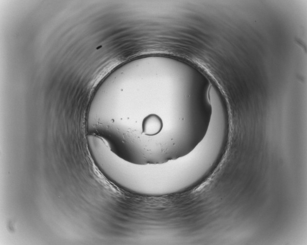 X0000099401137200805291204