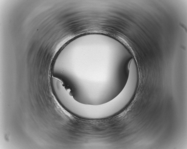 X0000099401141200805291205