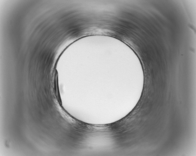 X0000099401152200805291205