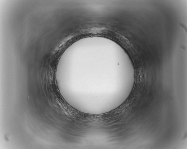 X0000099401158200805291204