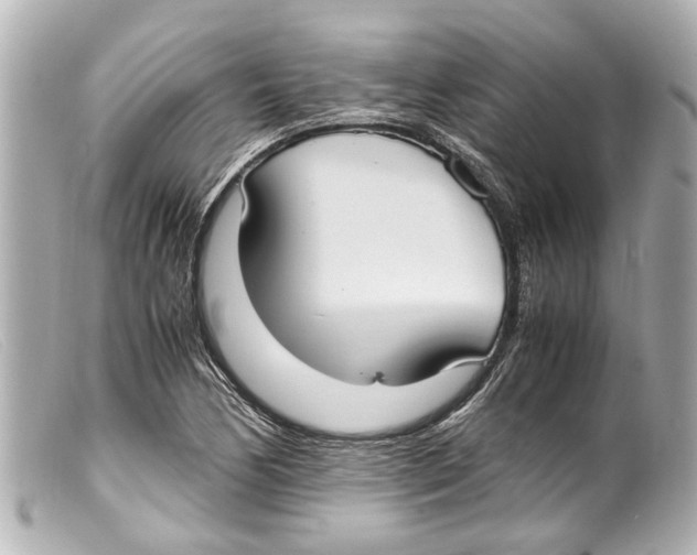 X0000099401170200805291204