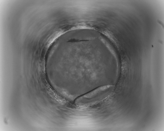 X0000099401173200805291204