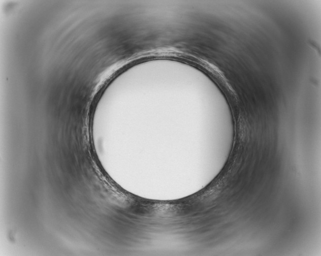 X0000099401176200805291204