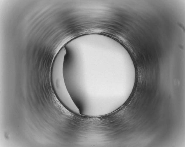 X0000099401186200805291203