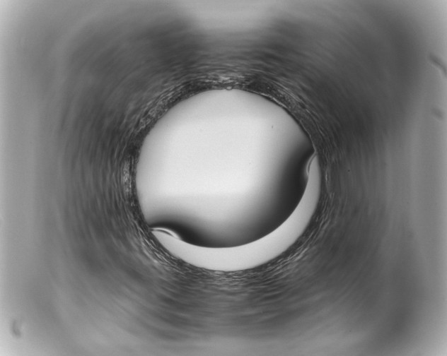 X0000099401395200805291200