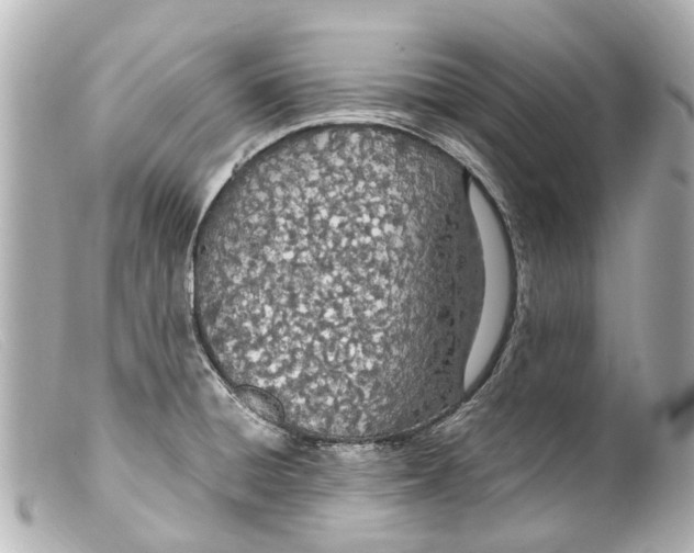 X0000099401428200805291201