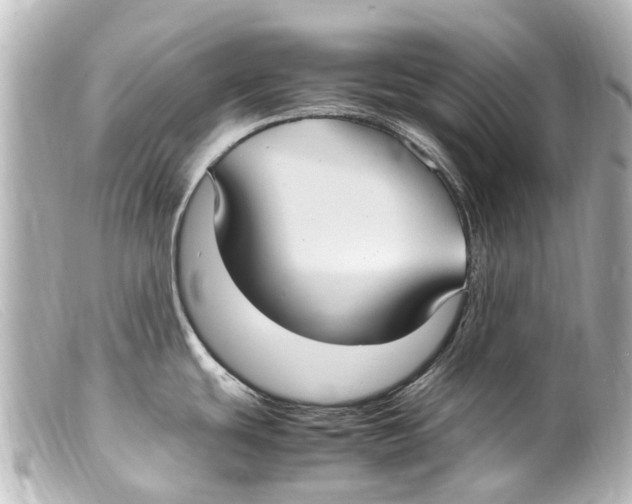 X0000099401439200805291201