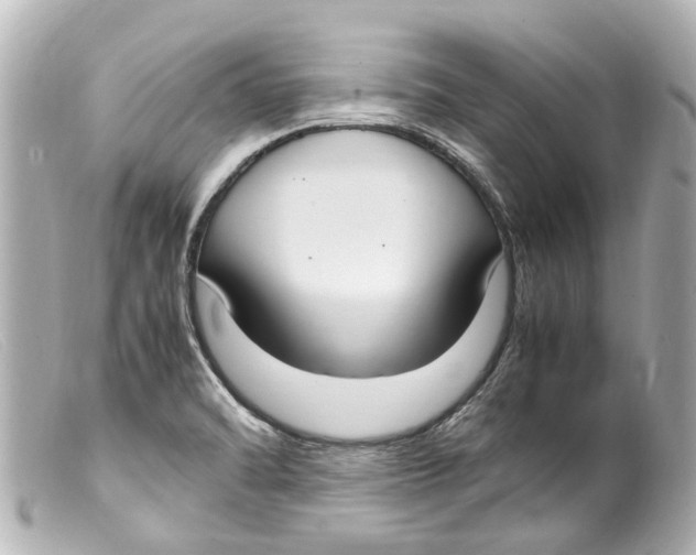 X0000099401470200805291200