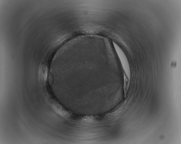X0000099400076200806051217