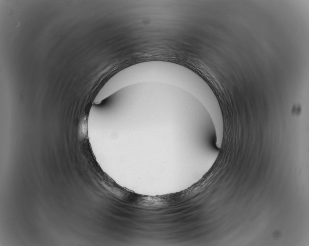 X0000099400095200806051217
