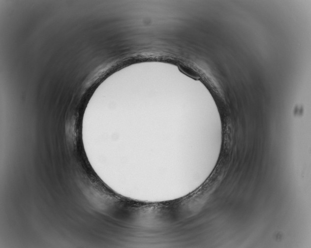 X0000099400116200806051216