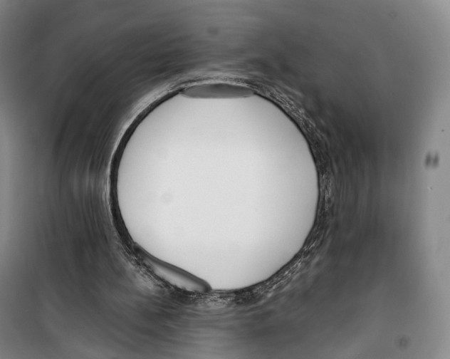 X0000099400148200806051215